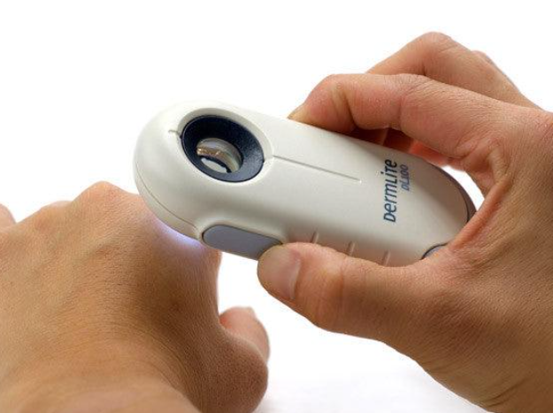 DermLite DL100